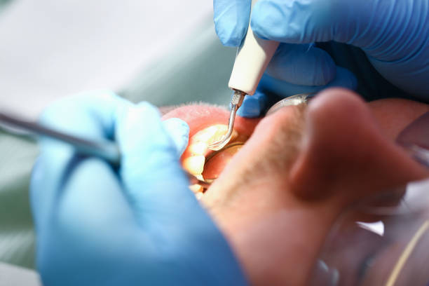 Best Urgent Dental Care for Toothaches in Coral Hills, MD