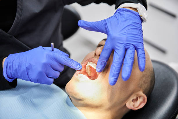 Best Knocked-Out Tooth (Avulsed Tooth) Treatment in Coral Hills, MD